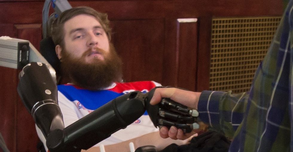 This robot arm is like a cochlear implant, but for touch. Watch it get turned on.
