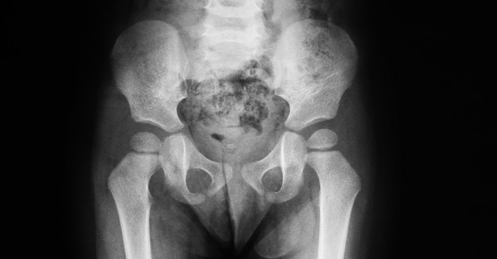 When it comes to discussing pelvic health with your daughter, the sooner the better.