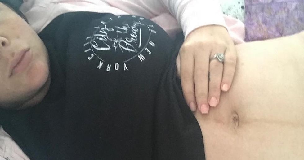 A mom's raw photo after a C-section shows how badass the female body is.