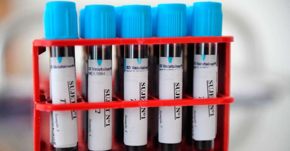 Why is some medicine less effective on women? Over 75% of lab animals are male.