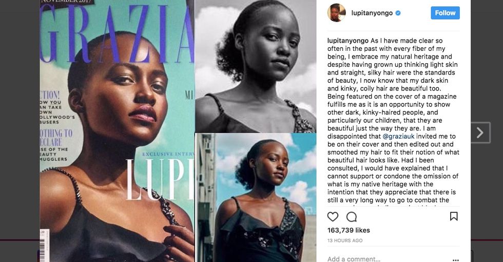 A magazine edited Lupita Nyong'o's hair on its cover, and she's really not having it.