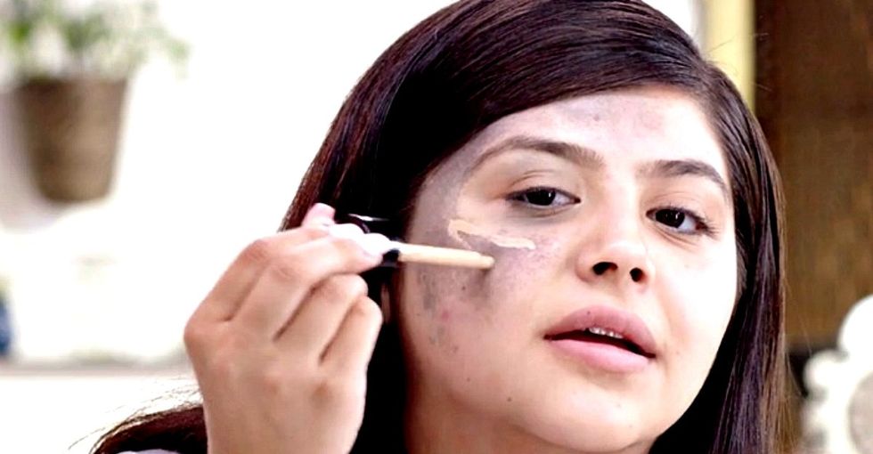 The awesome reason one girl went from hiding her 'flaw' to sharing it with millions.