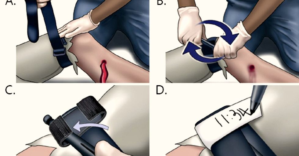 The vital reason these medical professionals want to teach you how to use a tourniquet.