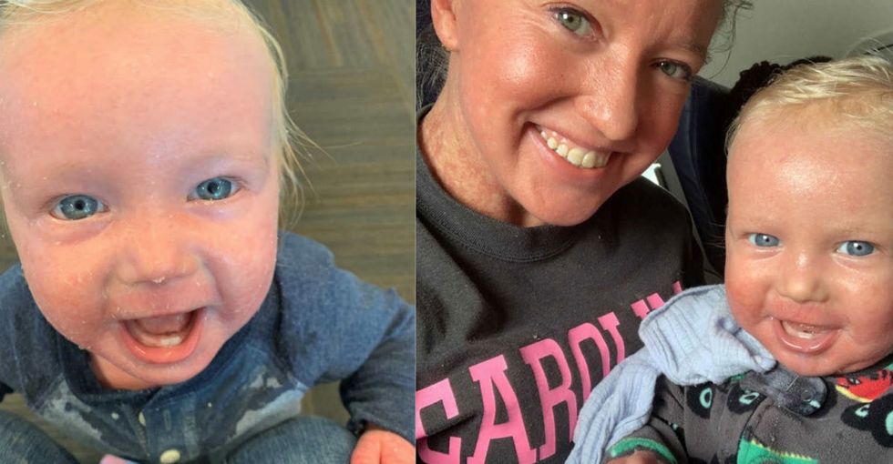American Airlines was forced to apologize after booting a mother and son with a completely harmless 'rash.'
