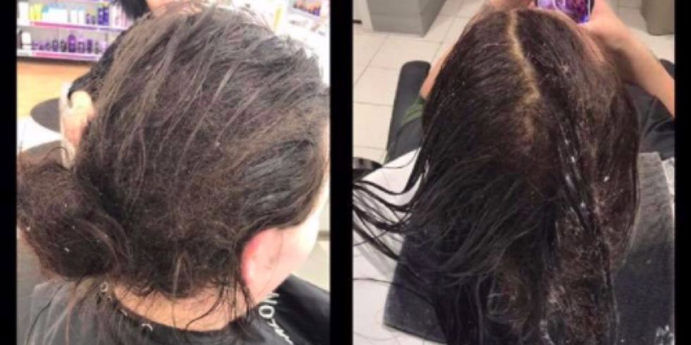 These before and after photos show how difficult living with depression can be
