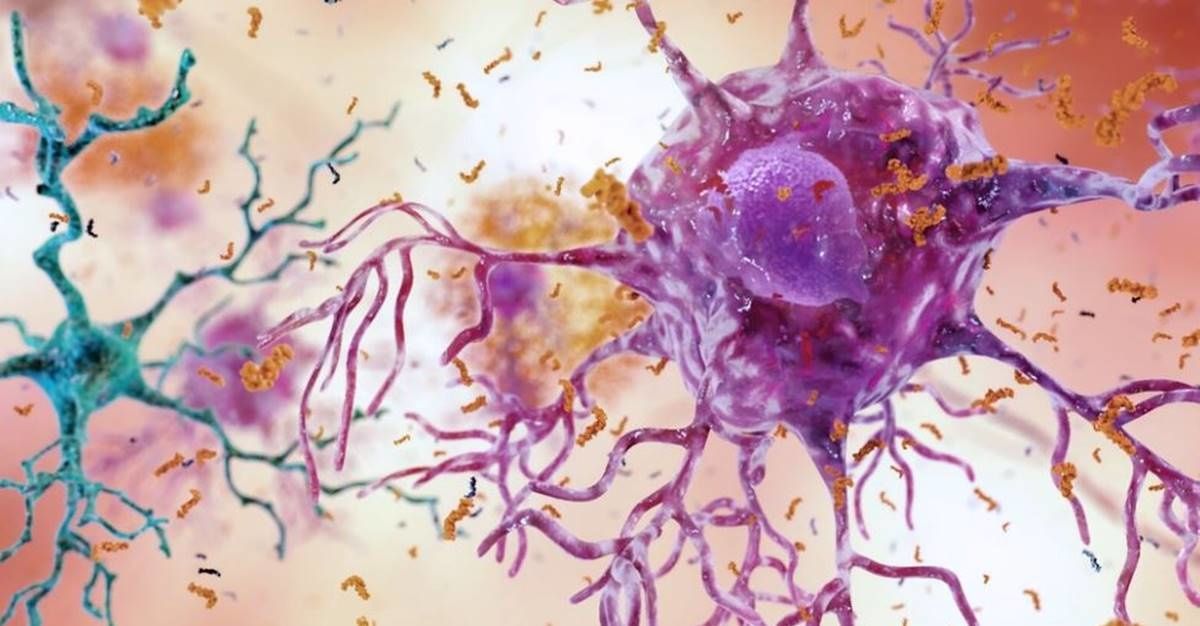 A mother-and-daughter team have developed what may be the world's first Alzheimer’s vaccine.