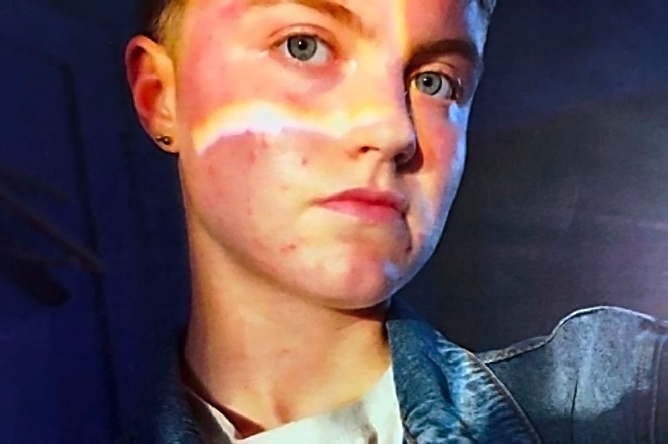 Voleva cambiare sesso, muore suicida. La triptorelina uccide in Inghilterra