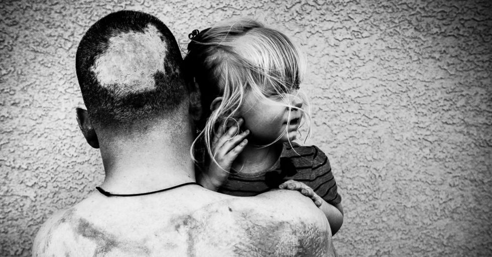 Powerful Images of Wounded Vets Show the Painful Reality of War