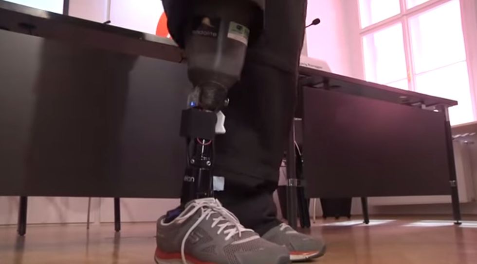 Prosthetics Breakthrough Lets Amputees “Feel” Their Artificial Limbs