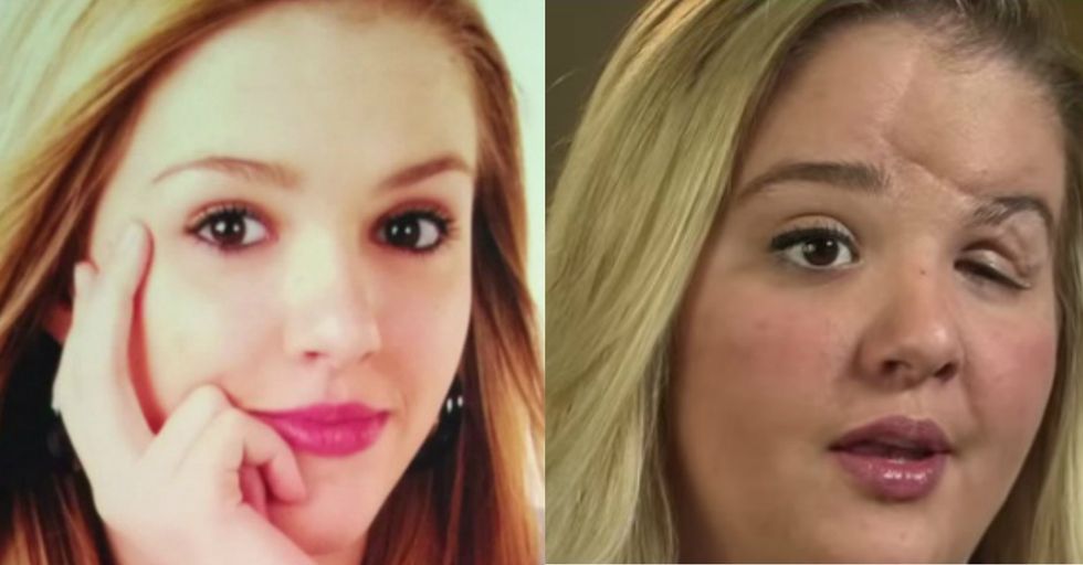 Daughter's Sad Plea For Friends On Facebook Just One Of Many Consequences From Accident