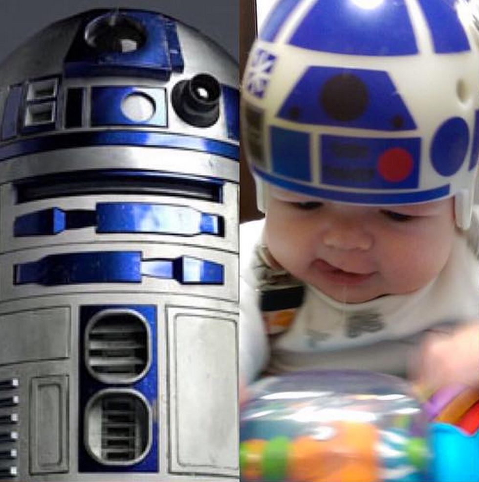 Jedi Master Dad Creates Awesome Star Wars-Inspired Helmets After His Son Undergoes Skull Surgery