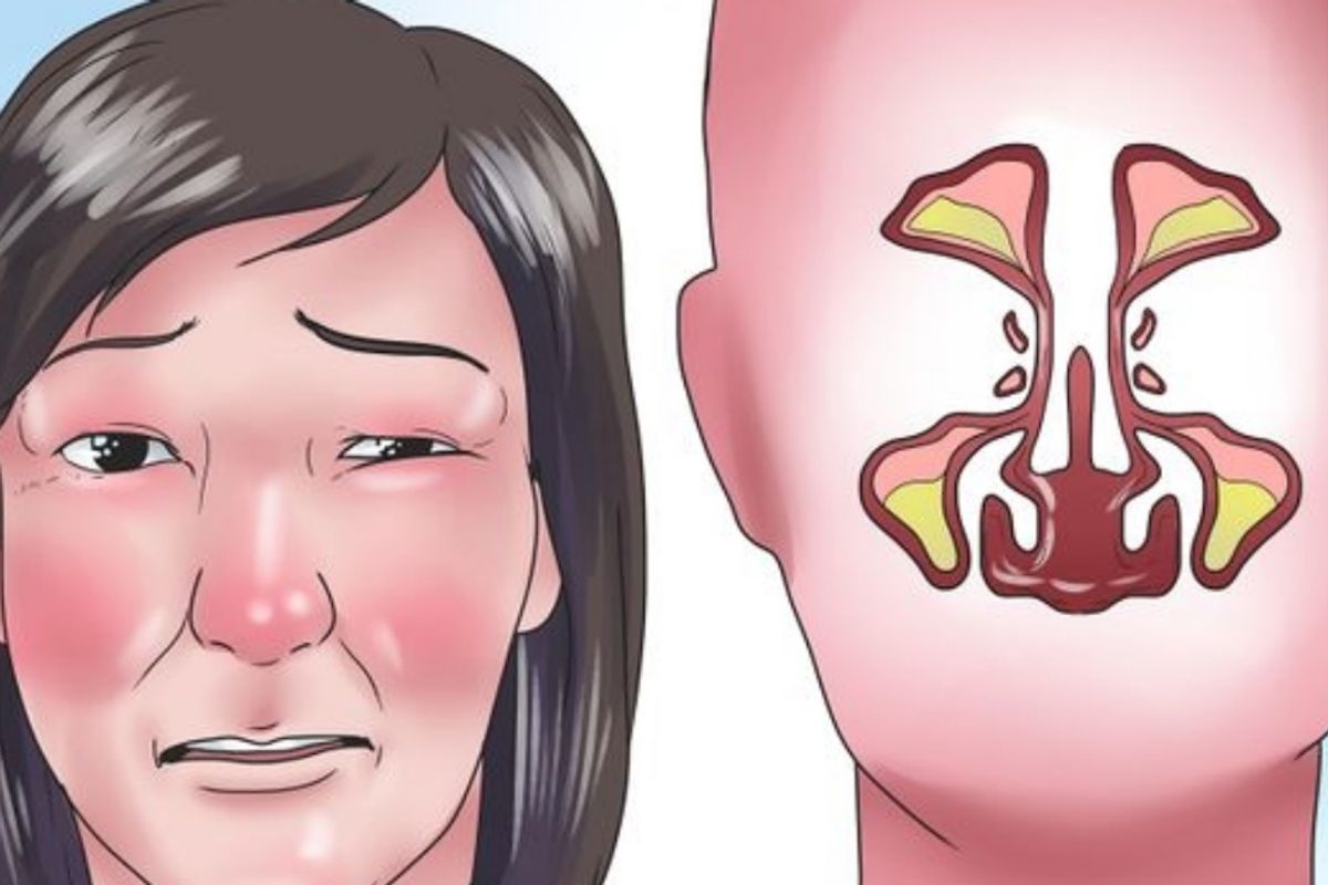 illustration of a woman with stuffy nose