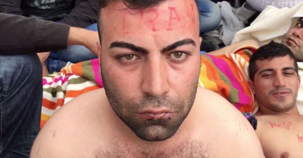 Refugees in Macedonia Sew Their Mouths Shut in Protest of Border Restrictions
