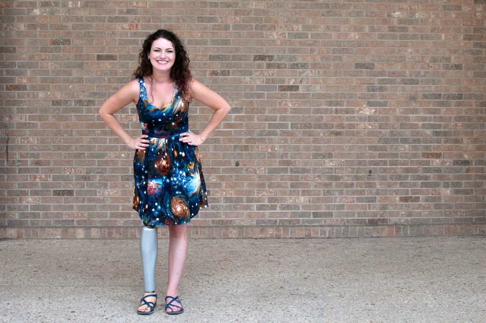 3D-Printed Covers Bring a Stylish Touch to Prosthetic Limbs