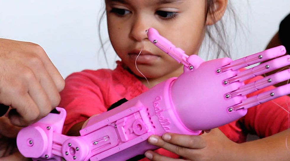 Designers Create Custom 3D-Printed Arm for Adorable 5-Year-Old