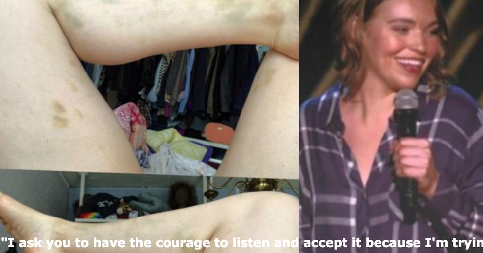 Comedian Shares Disturbing Details About an Abusive Relationship