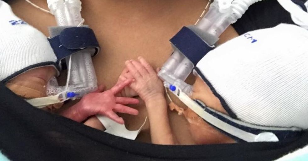 Heartwarming Photo of Premature Twins Holding Hands Shows the Power of Sibling Love