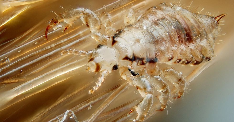 Treatment-Resistant Super Lice Has Spread Across 25 States