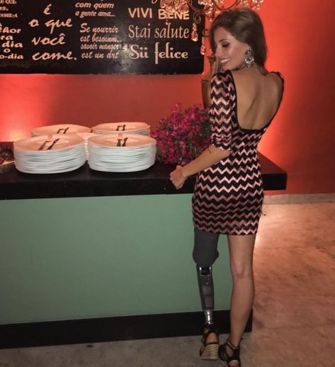 Paola Antonini França Costa Poses With Her Prosthetic Leg To Empower ...