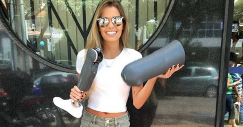 Paola Antonini França Costa Poses With Her Prosthetic Leg to Empower Amputees