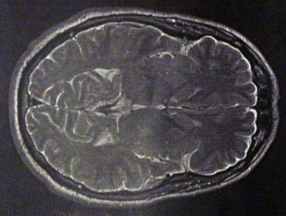 Why It's Good That Your Brain Is Shrinking GOOD