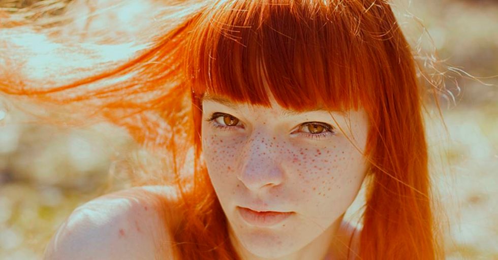 Why Do People Have Freckles?