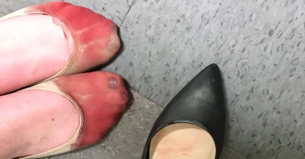 Server forced to wear heels on the job shares photos of her bloody feet.