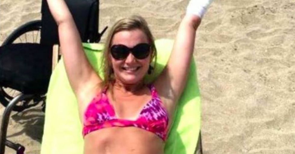 Aimee Copeland Shows Off Beach Body After Surviving Flesh-Eating Bacteria