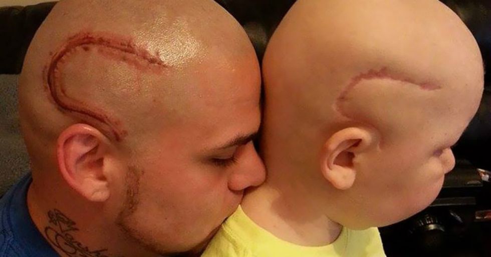 Dad Gets Tattoo To Match Son’s Cancer Surgery Scar