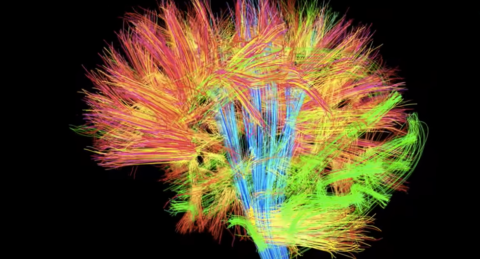 Stunning New Map Of The Brain Shows 97 Previously Unknown Regions