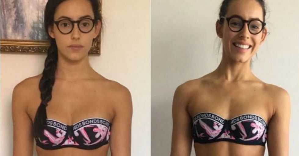 This woman’s side-by-side photos destroy a major weight-loss misconception.