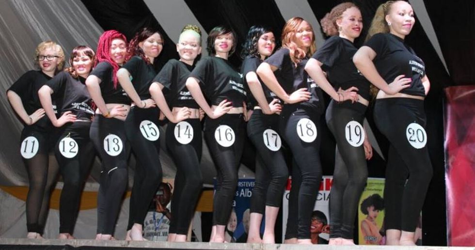 Kenya Holds The World’s First Albino Beauty Pageant