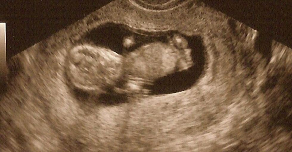 A Mother’s Blood Pressure Could Be Tied To The Baby’s Gender, According To A New Study