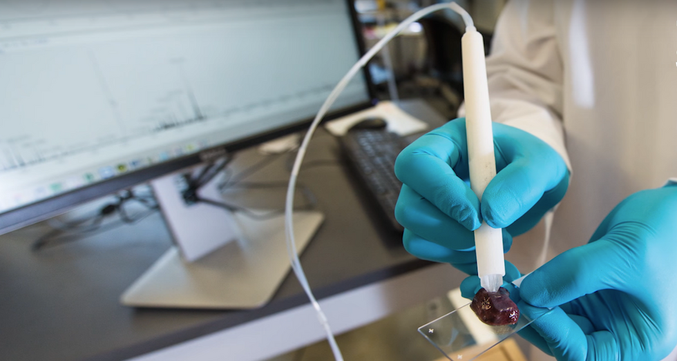 Can A Simple Pen Help Doctors Diagnose Cancer?