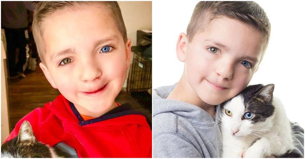 Boy With Two Rare Conditions Rescued A Cat That’s Just Like Him