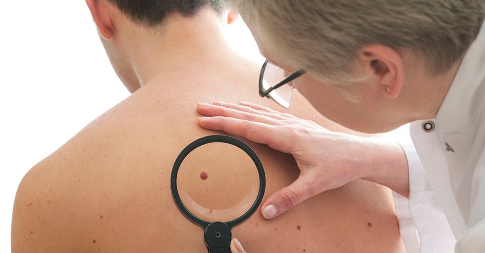 This App Can Detect Signs Of Skin Cancer From Photos Of Your Skin
