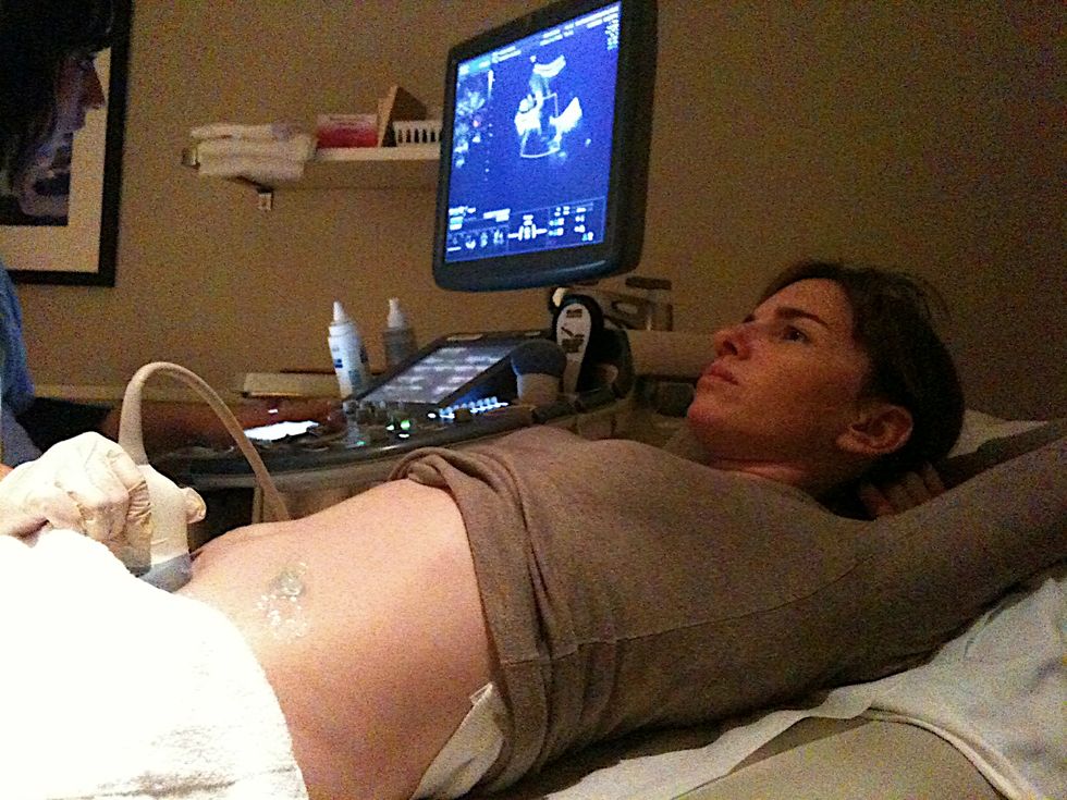 Reducing False Positives in Prenatal Genetic Screenings