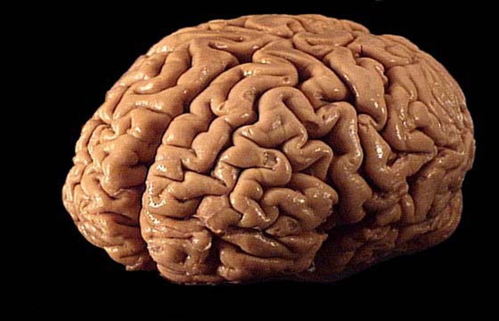 The New York Brain Bank is Like the Walmart of Brains
