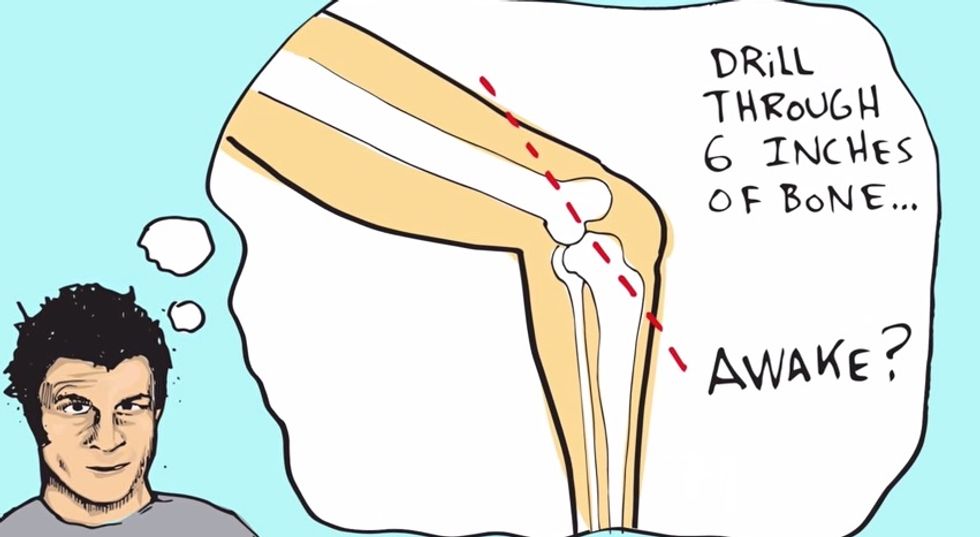BMX Superstar Mat Hoffman’s Animated Tale Of Anesthesia-Free Experimental Surgery