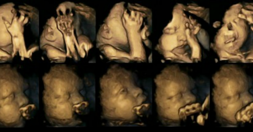 Ultrascans Show Fetuses Reacting To Mothers' Smoking
