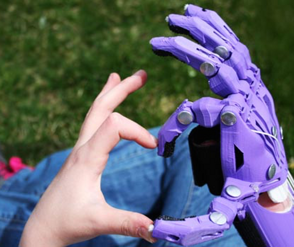 Seven-Year-Old Faith Lennox’s 3D Printed Arm Cost $50