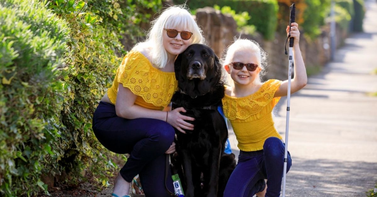 Mom Of Two Daughters With Albinism Explains Their Unbreakable Bond