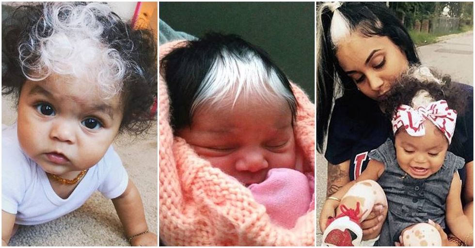 Beautiful Baby Is The Fourth Generation Born With A White Streak In Her Hair