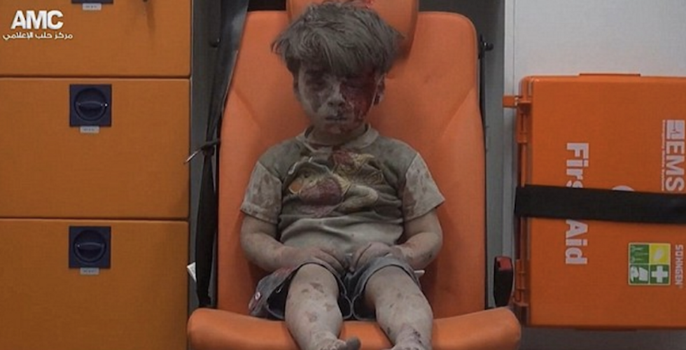 Boy Who Survived Airstrike Shows Us Everything Awful About War