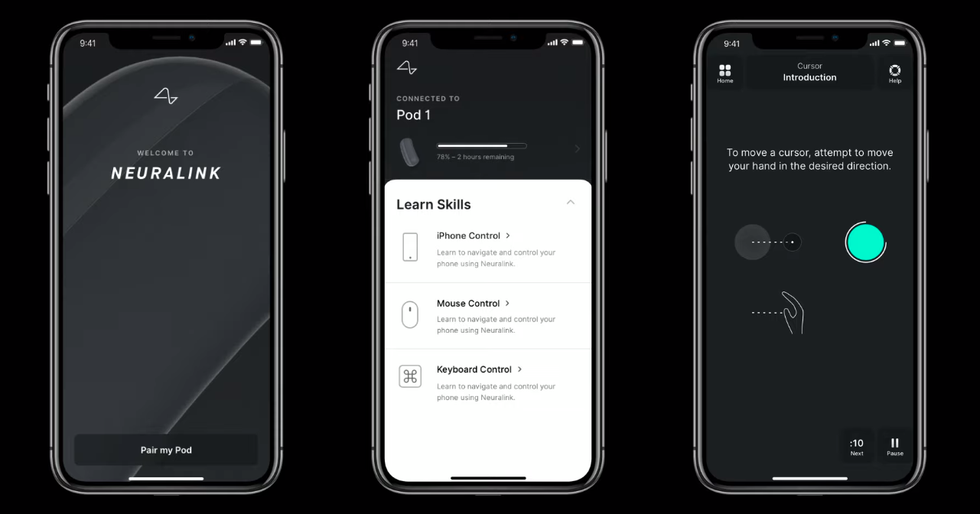 Images of a Neuralink iPhone app