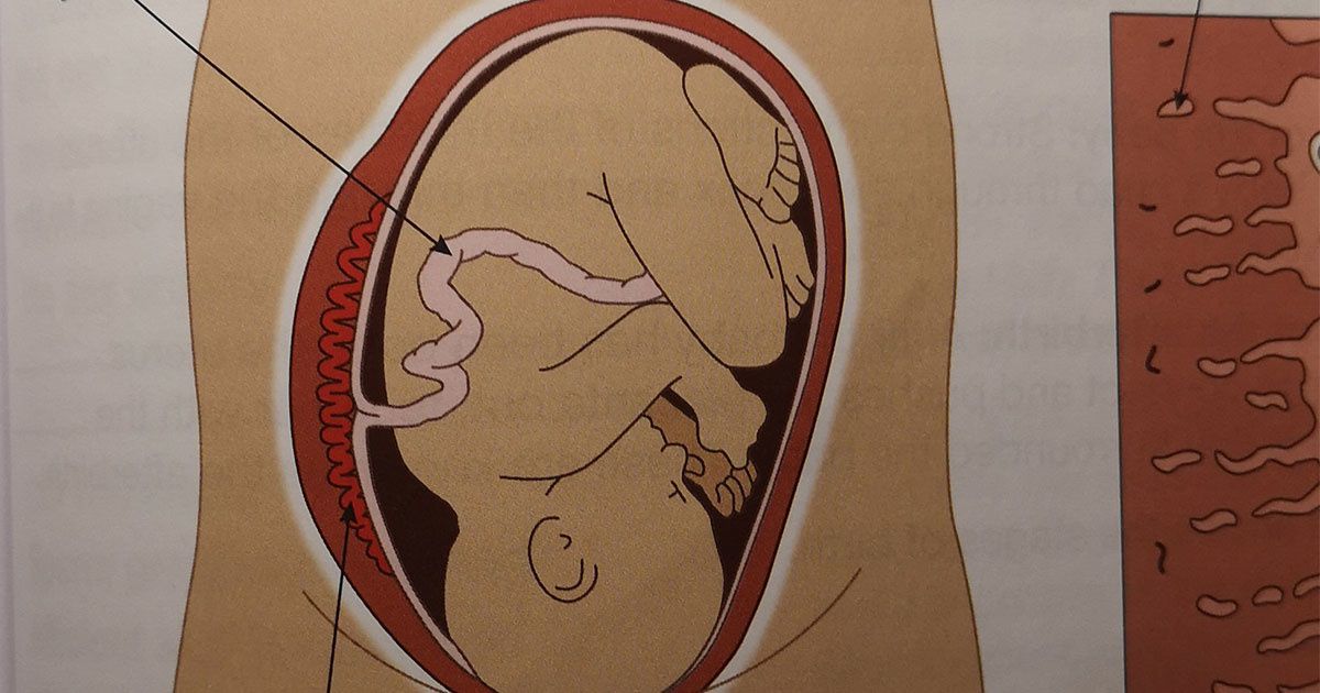 Pearson science textbook show pregnant woman with Brazilian wax