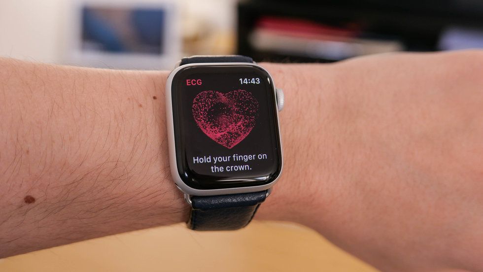 Smart watch with online ekg