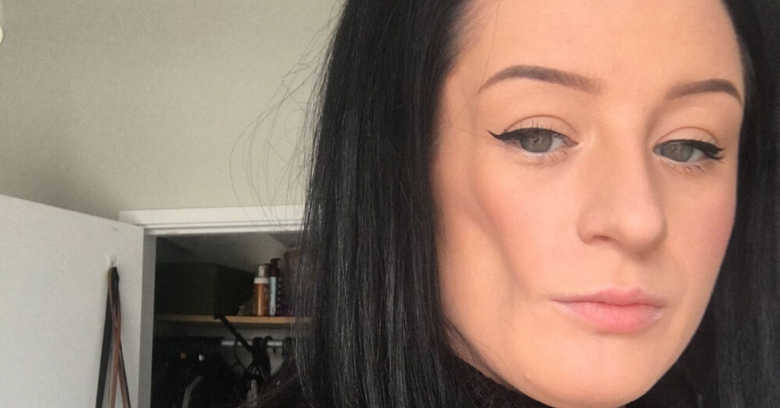Woman With Rare Condition That Made Her Face Sink In Has Cheek Rebuilt With Fat From Her Stomach