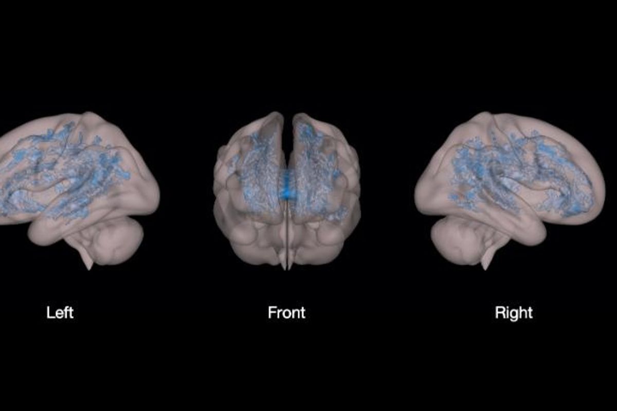 Scientists finally know what screen time does to your toddler's brain