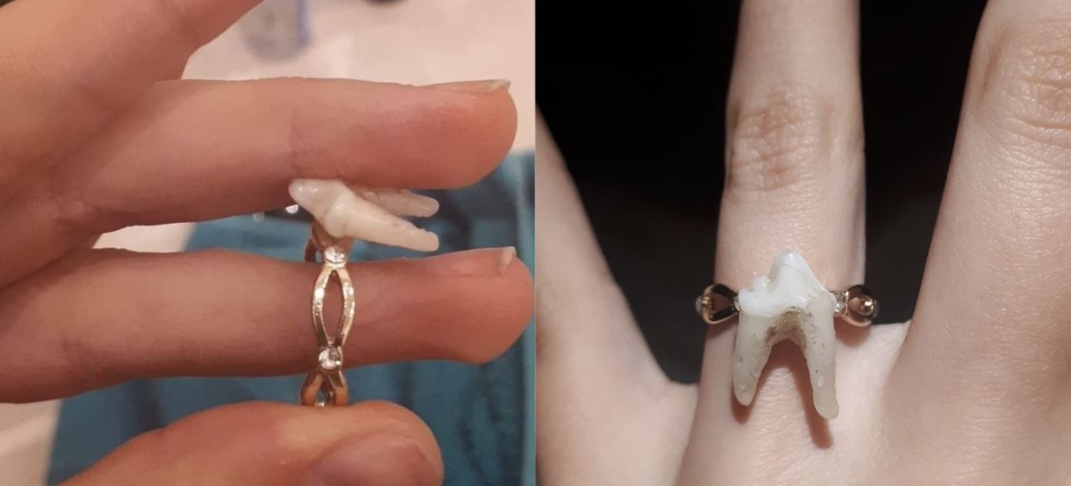 Couple's Promise Rings Made From Poodle And Wolf Teeth Cause Stir Online